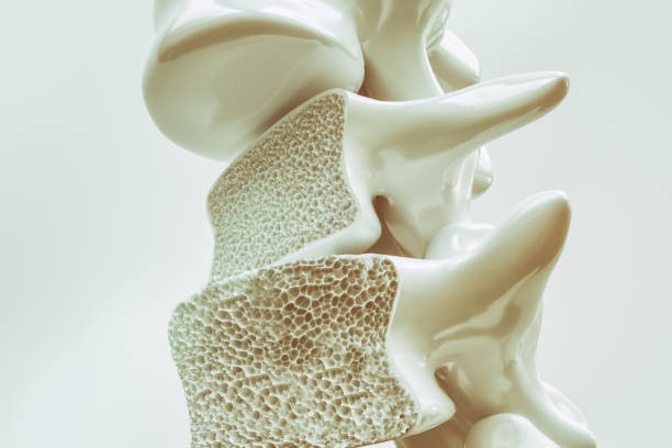 The importance of strength training for bone density at Fortis Fit Personal Training Sydney.